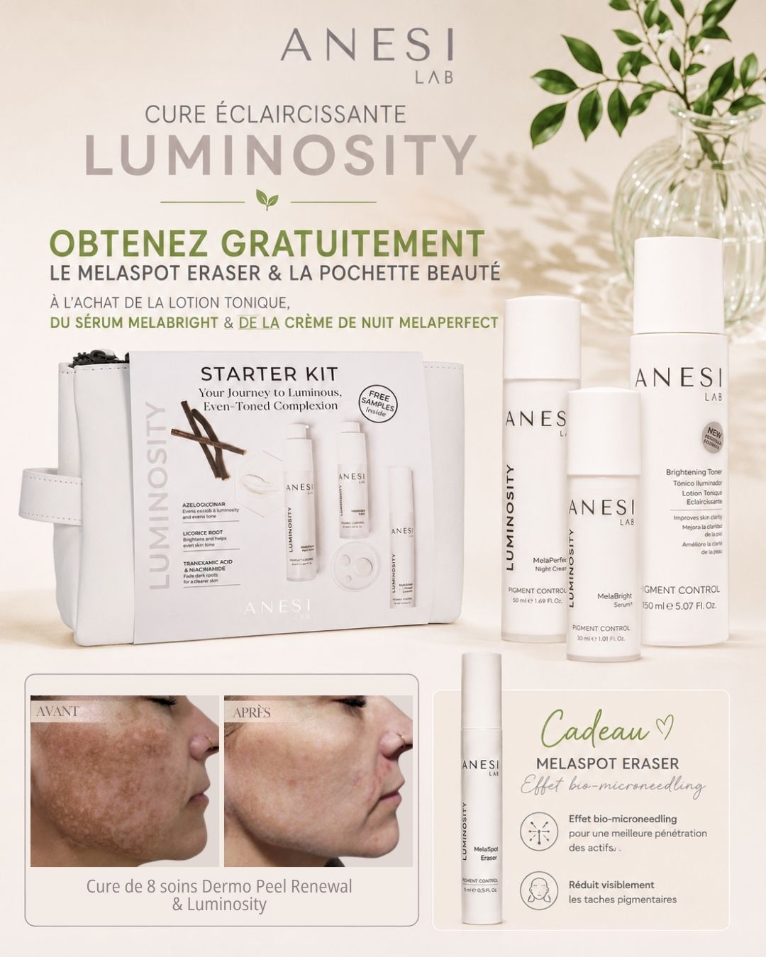 Taches pigmentaires : avant à gauche et après à droite, cure ANESI de huit soins Dermo Peel Renewal et Luminosity
